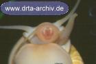 Apfelschnecke Apfelschnecke